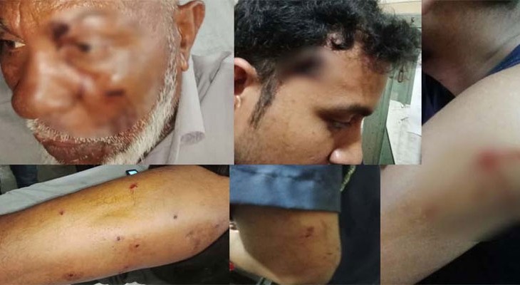 পদ্মা নদীতে পুলিশের ওপর সন্ত্রাসী হামলা, ওসিসহ ৫ সদস্য গুলিবিদ্ধ