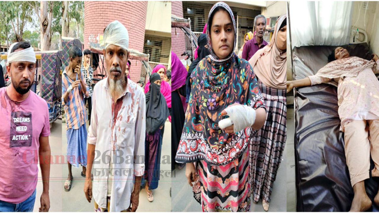 সিদ্ধিরগঞ্জে জমি সংক্রান্ত বিরোধে দুই পক্ষের সংঘর্ষ: নারীসহ আহত ৭