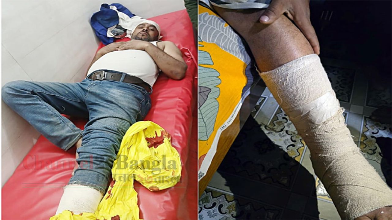 সোনারগাঁয়ে নিজ দলের নেতাকর্মীদের হামলায় যুবদল নেতা দুলাল আহত 