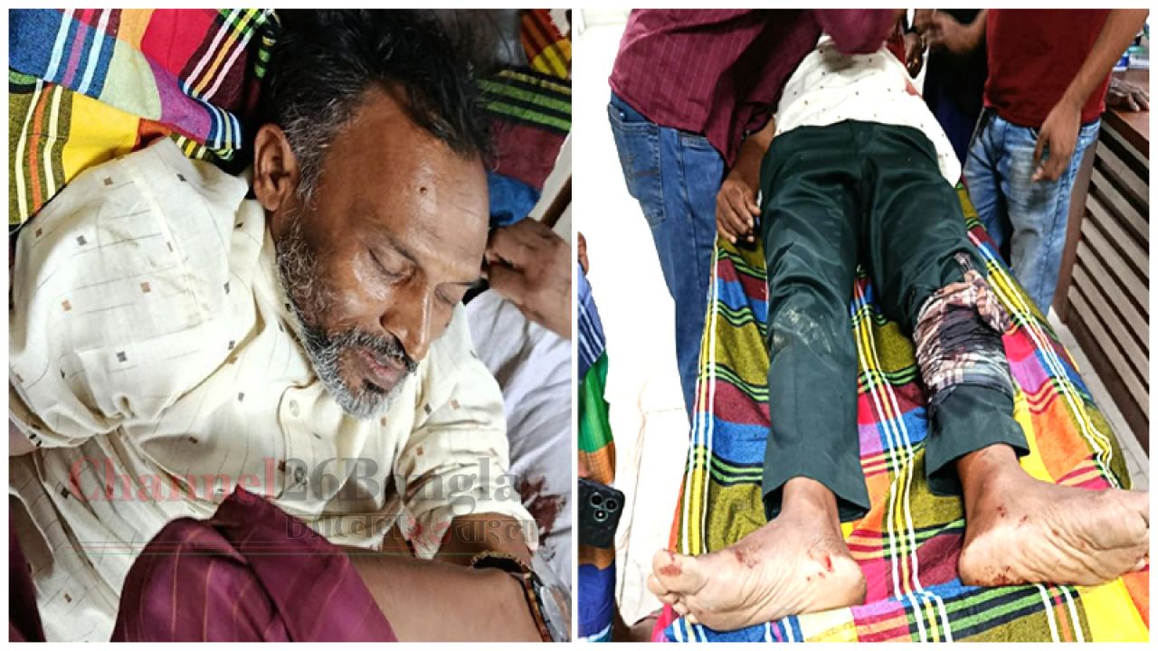আড়াইহাজারে চাঁদা না দেওয়ায় প্রধান শিক্ষকের ওপর হামলার অভিযোগ