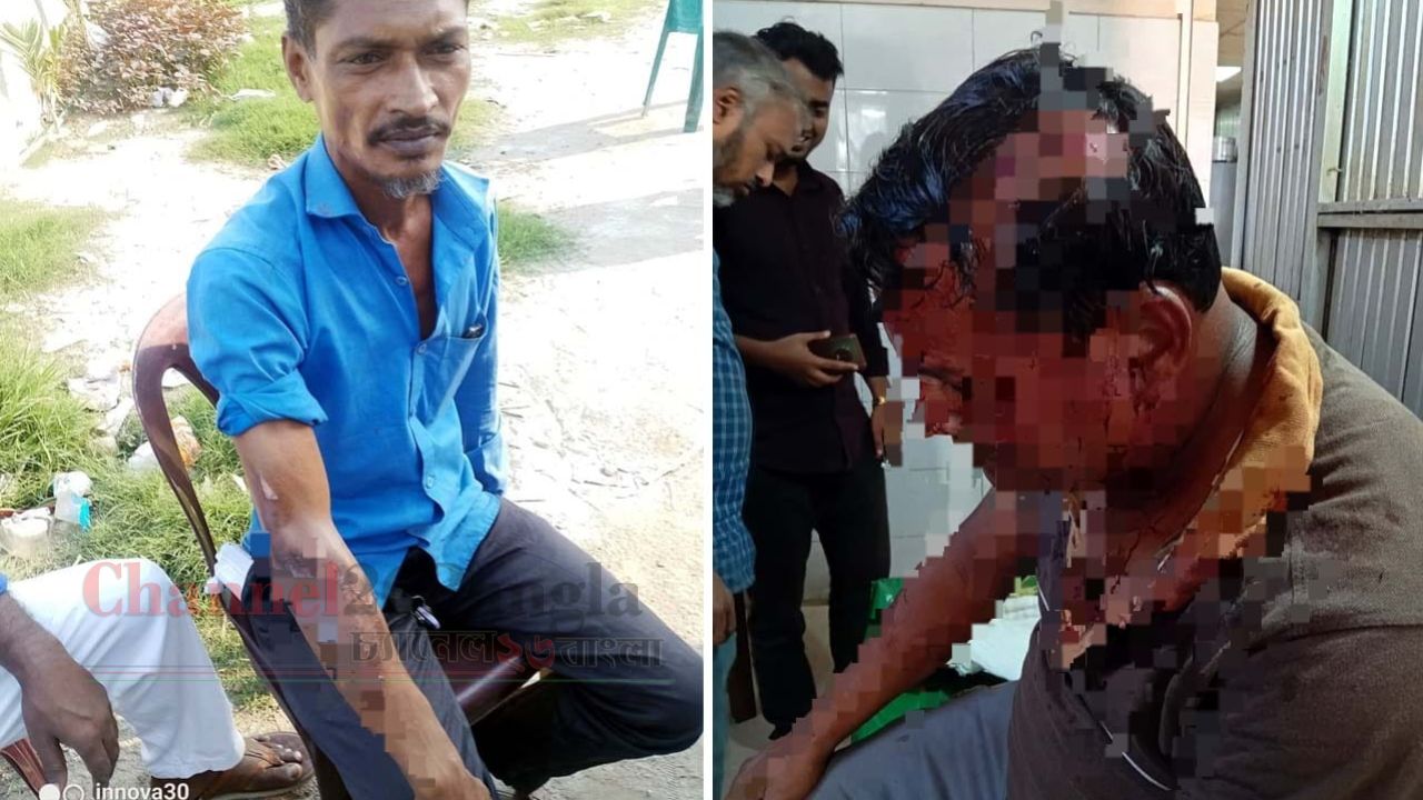 সিদ্ধিরগঞ্জে বিএনপির দুই গ্রুপে সংঘর্ষ: আহত ৩