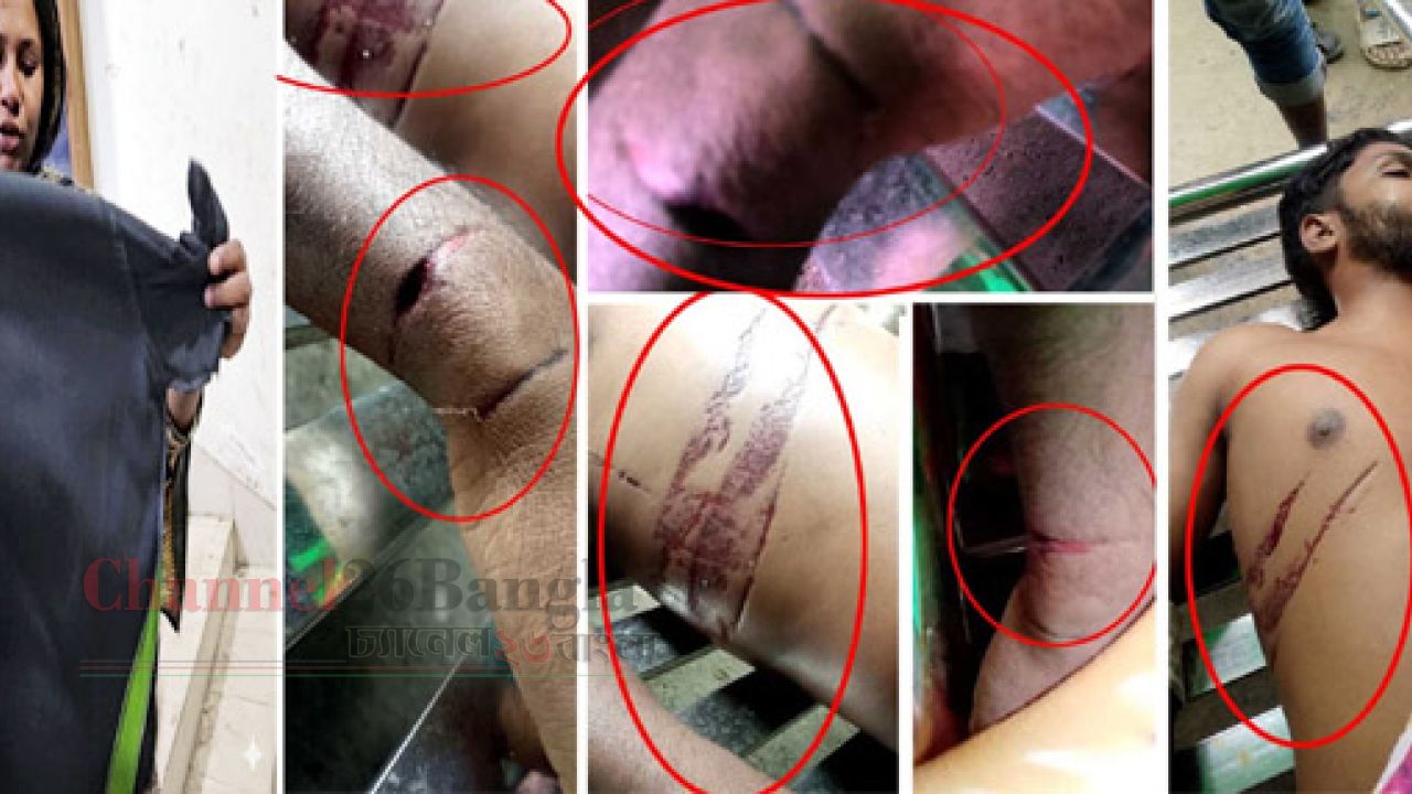 সিদ্ধিরগঞ্জে পোশাক শ্রমিকের মৃত্যু নিয়ে ধুম্রজাল আঘাতের চিহ্ন দেখে হত্যার অভিযোগ: মামলা নেয়নি পুলিশ