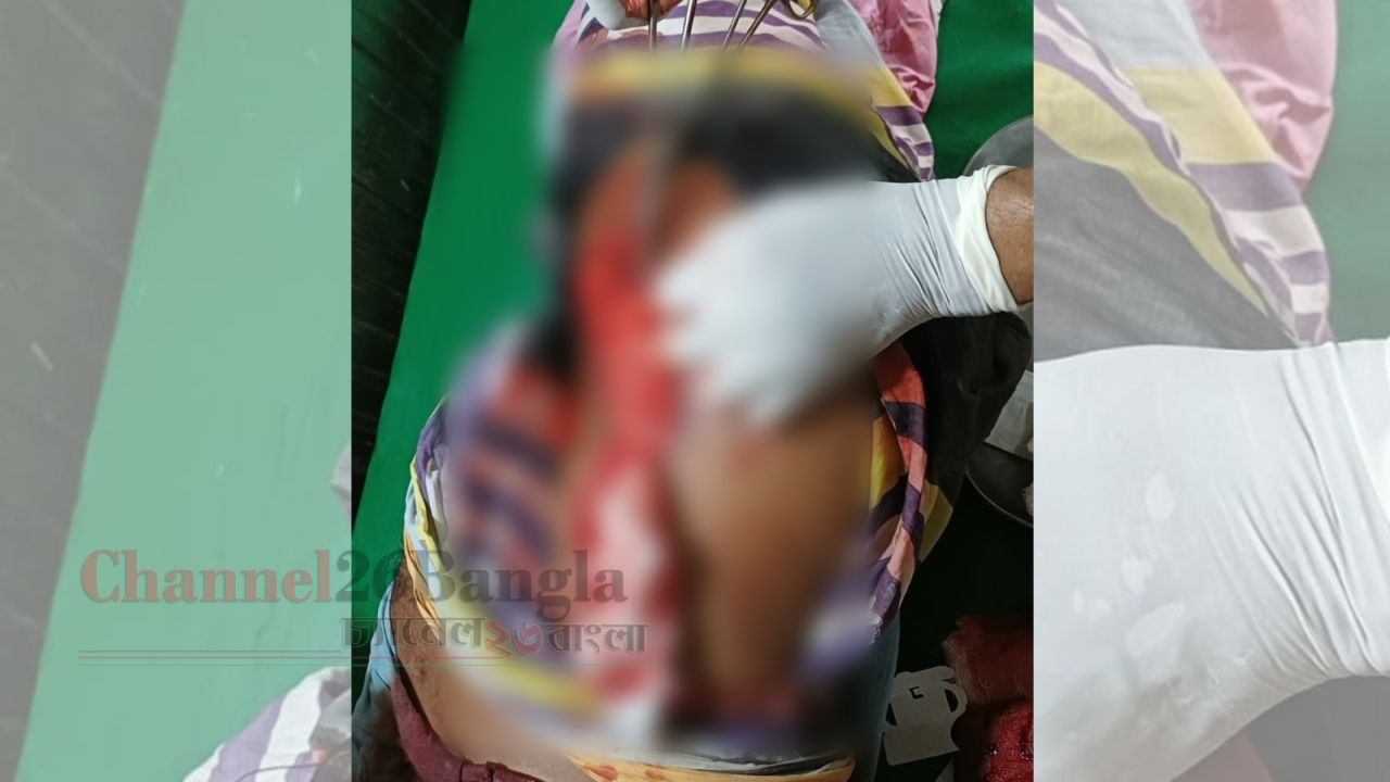 সিদ্ধিরগঞ্জে মামলা তুলে না নেওয়ায় বিএনপি নেতার ভাইকে কুপিয়ে জখম