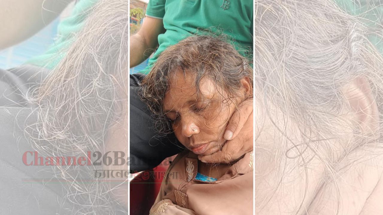 কথিত মলম পার্টির খপ্পরে পড়ে হাসপাতালে নারী
