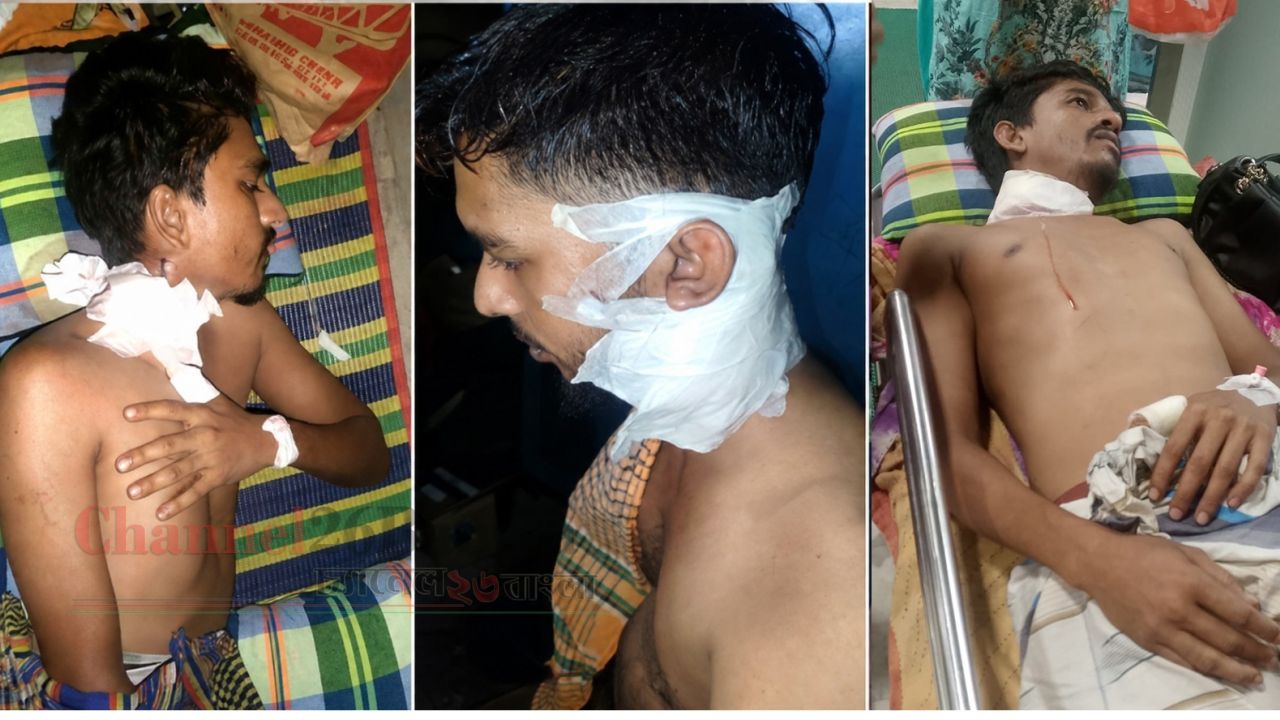 সিদ্ধিরগঞ্জে অপহরণে বাধা দেওয়ায় সশস্ত্র হামলা: রামদার কোপে দুই যুবক গুরুতর আহত