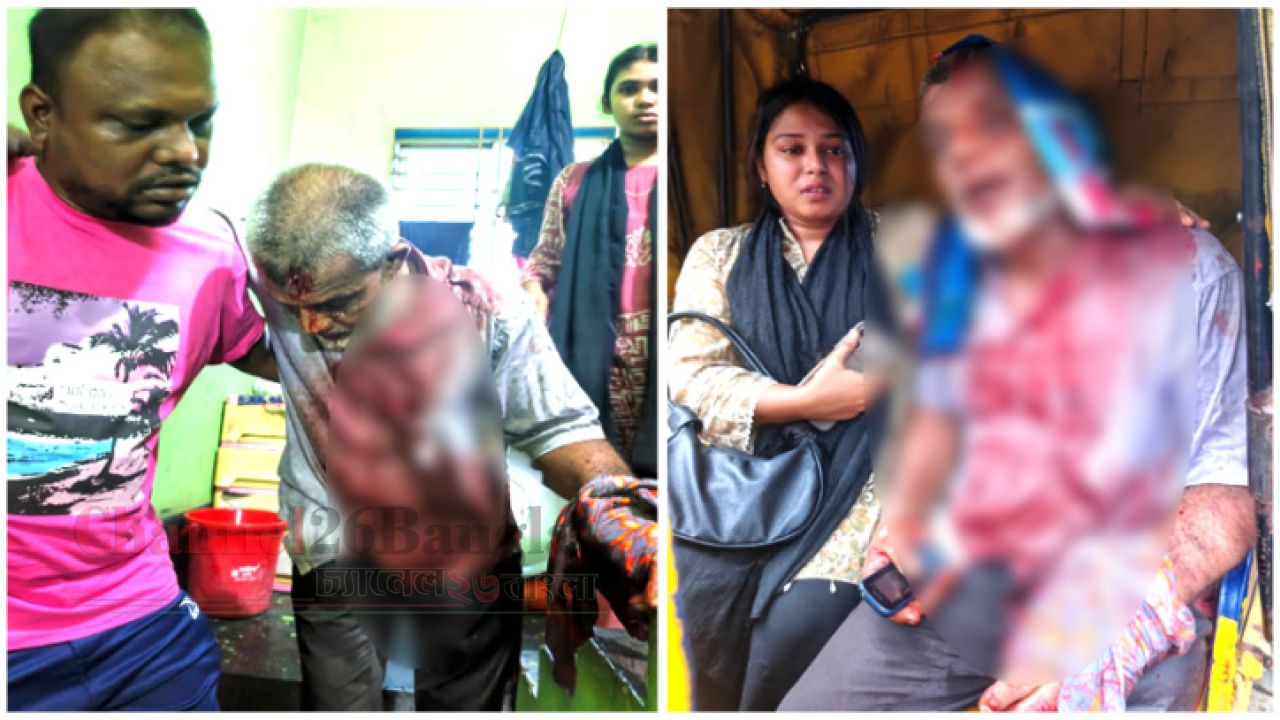 ছেলে হত্যা মামলা তুলে নিতে এবার বাবাকে কুপিয়ে জখম ও গুলি