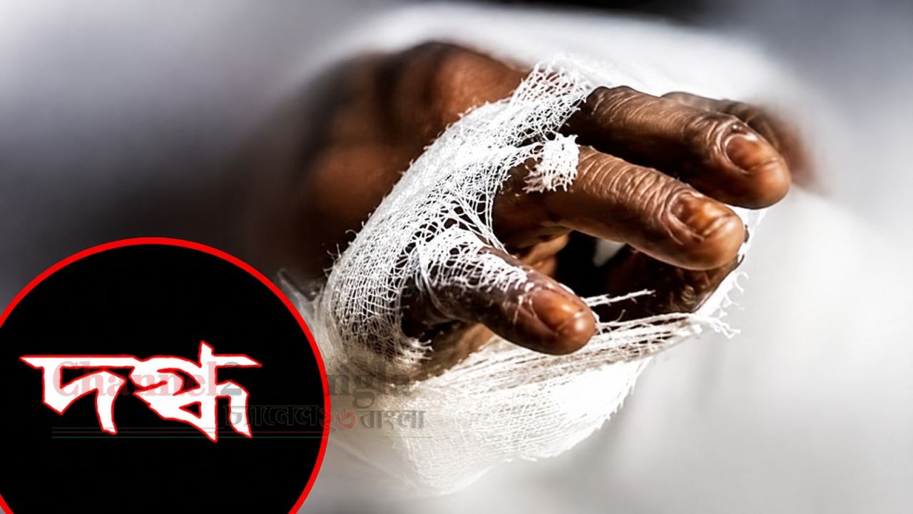 ফতুল্লায় অবৈধ গ্যাস সংযোগ দিতে গিয়ে বিস্ফোরণ: দগ্ধ ৪