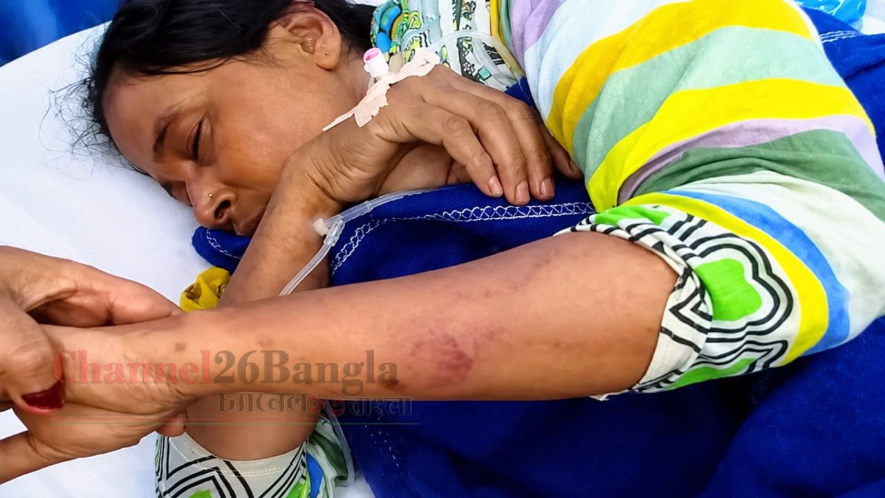 সিদ্ধিরগঞ্জে তরকারি বিক্রেতার লাঠির আঘাতে গার্মেন্টস কর্মী সংকটাপন্ন