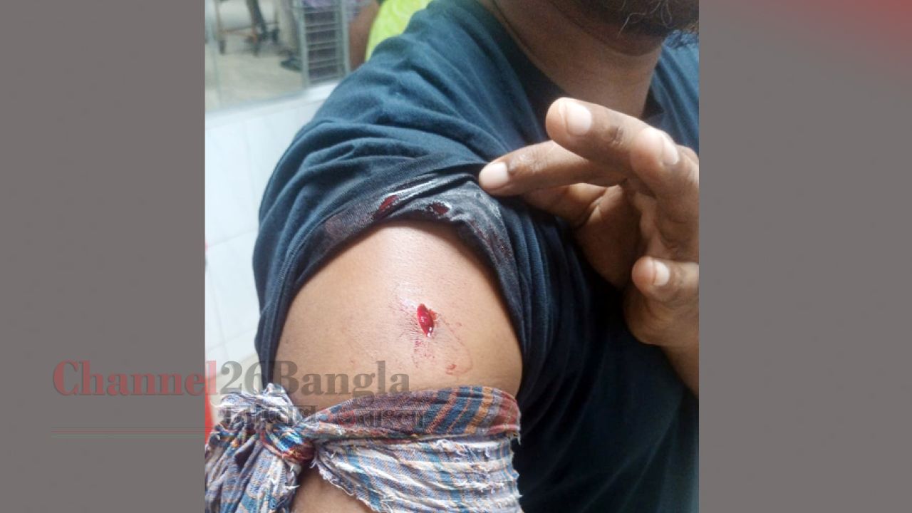 চিটাগাং রোডে মাইক্রোবাসে ছিনতাইয়ের চেষ্টা: চালককে ছুরিকাঘাত